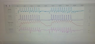 Pro Training Heart Rate Graph Data