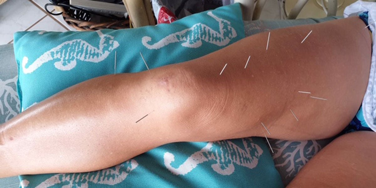 Ironman World Championships recovery rehab